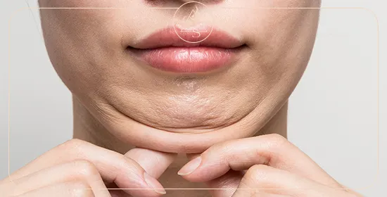 آیا ساکشن غبغب بیهوشی دارد؟