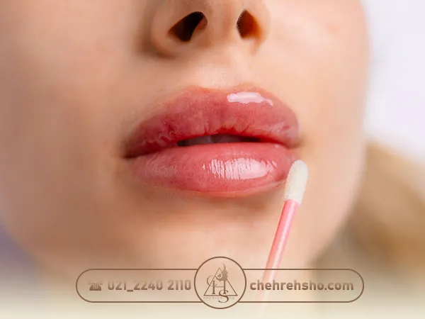 عوارض و مضرات تزریق ژل لب