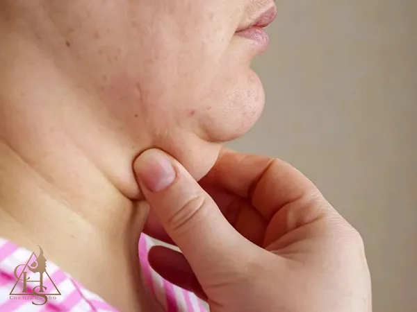 مشاوره و بررسی اولیه برای انجام لیپوساکشن غبغب
