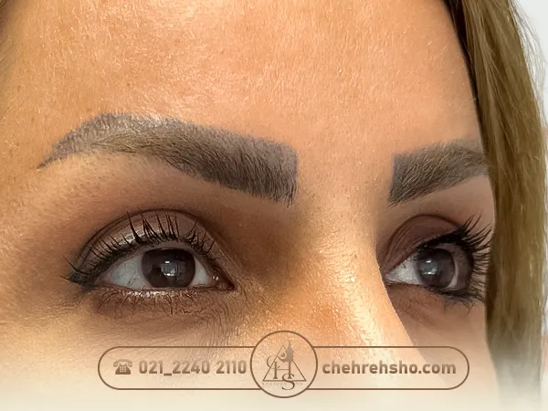 پیوند ابروهای تاتو شده