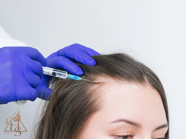 پر کردن حجم شقیقه با تزریق کردن ژل