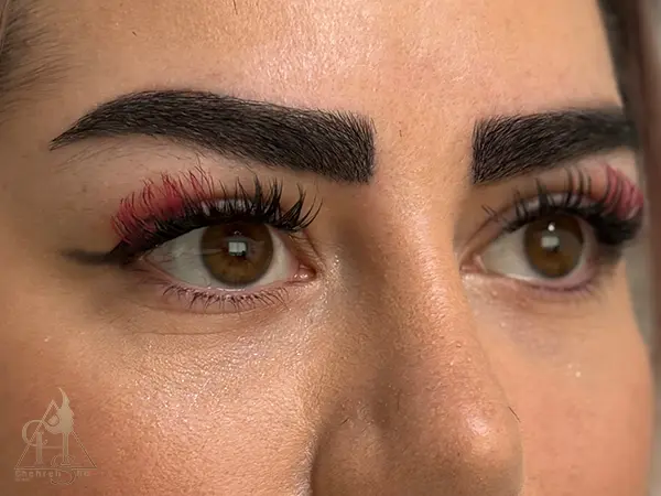 کاشت ابرو و مشاوره انتخاب بهترین پماد در کلینیک زیبایی چهره شو