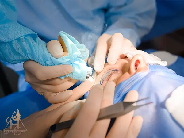انجام بوتاکس و بلفاروپلاستی با فاصله زمانی مناسب در چهره شو