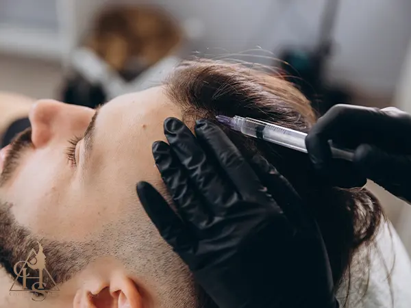 تعداد جلسات مزوتراپی برای اثرگذاری روی موهای کاشته شده