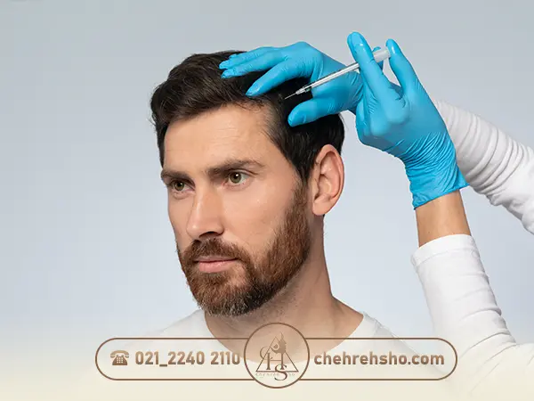 مزوتراپی پس از پیوند مو