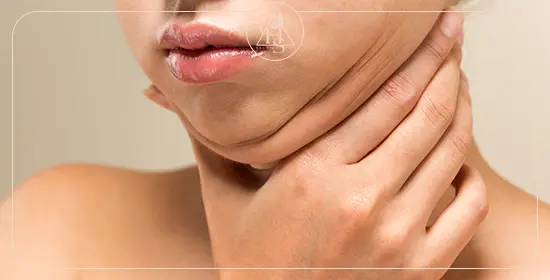 همه چیز درباره ساکشن غبغب