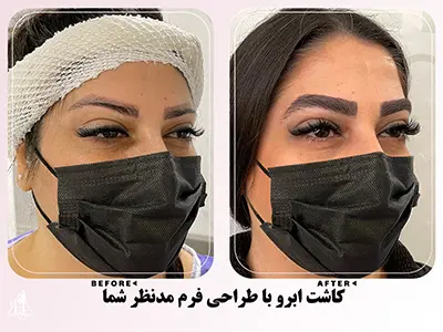 نمونه کاشت ابرو 21