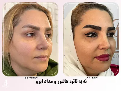 نمونه کاشت ابرو 19
