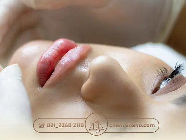بی حسی مناسب برای تزریق ژل لب