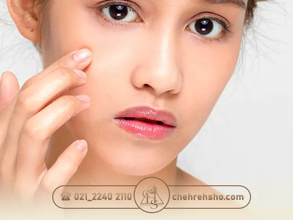 دلایل افتادگی پوست بعد از تزریق ژل