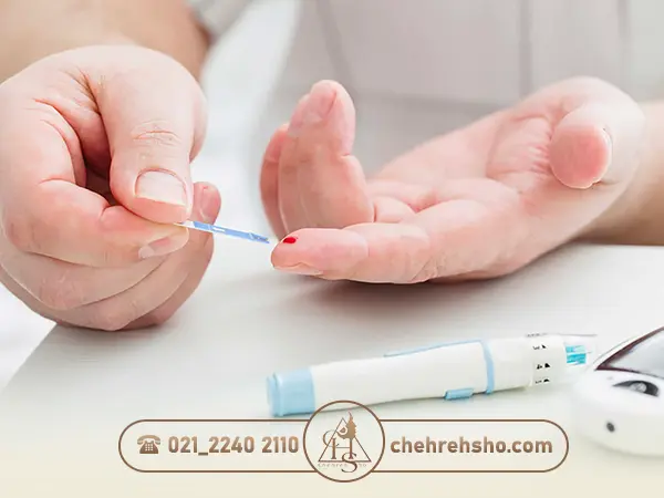 کاشت و پیوند مو برای مبتلایان به دیابت