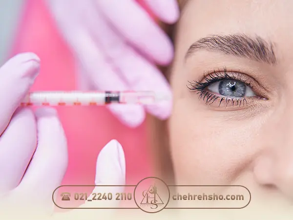 تزریق ژل برای بهبود گودی زیر چشم