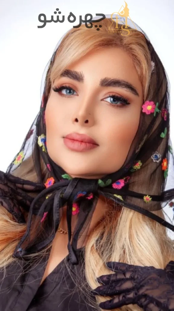 اجرای بی‌نقص کاشت ابرو تریکوتیلومانیا در کلینیک زیبایی چهره شو