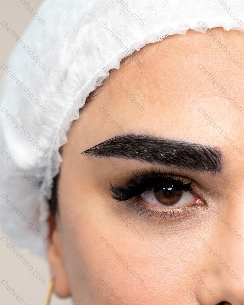 نتیجه کاشت ابرو طبیعی